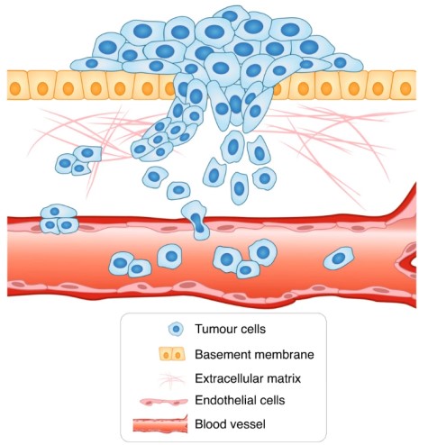 The model of cancer cell migration and invasion.