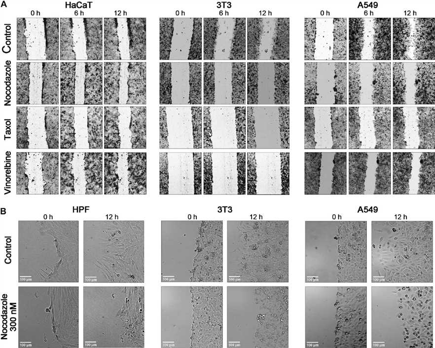 Comparison of the time course of wound closure with the anti-MT drugs in a 12-h interval. (OA Literature)