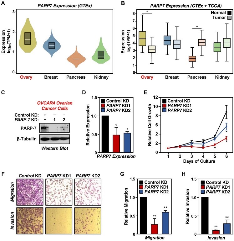 Expression of PARP-7 in cancers and its role in ovarian cancer cell phenotype.
