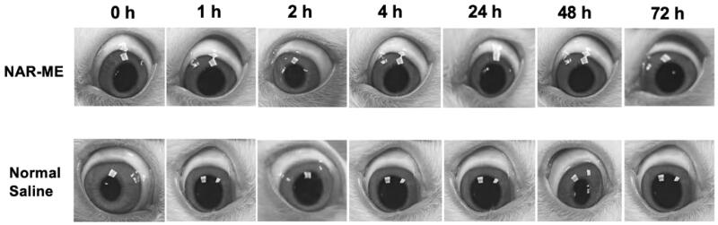 Local ocular reaction observed under slit lamp microscope after in vivo single instillation of 0.5% NAR-ME or normal saline (served as control). (Yu Ma, et al., 2022)