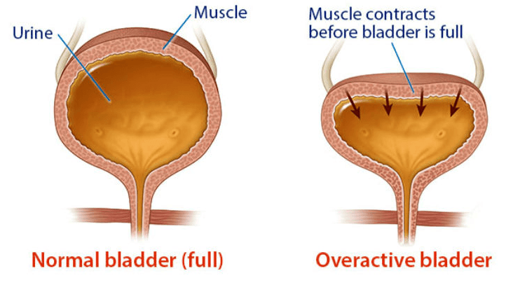 Overactive Bladder Activity Oab Model Creative Biolabs