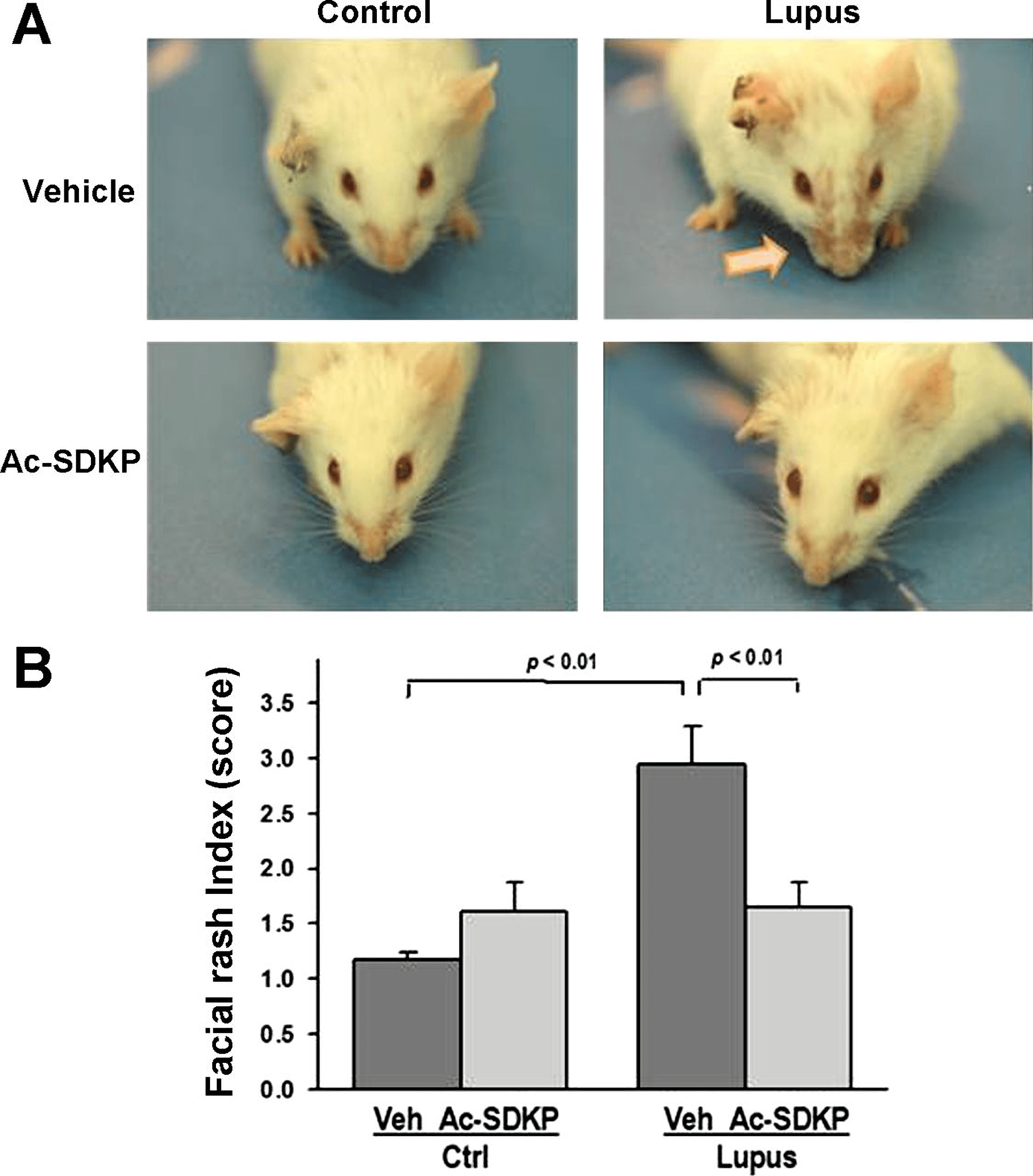 Spontaneous Systemic Lupus Erythematosus (SLE) Mouse Model - Creative  Biolabs