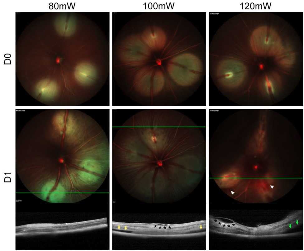 Fig. 1 The images of fundus fluorescein angiography in RVO mouse models. (OA Literature)