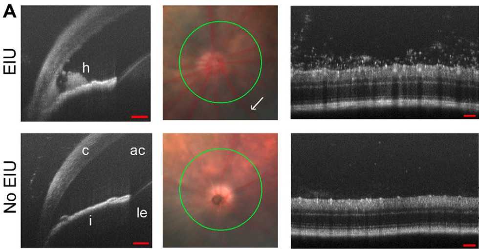 Fig. 2 Images of endotoxin-induced uveitis (EIU) model. (OA Literature)