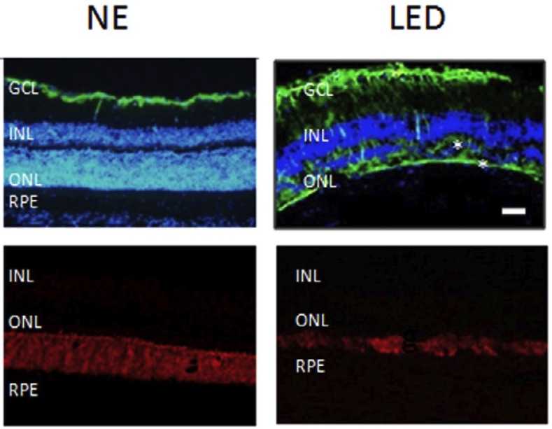 Fig. 1 Pictures of retinal damage caused by LED exposure in rats. (OA Literature)