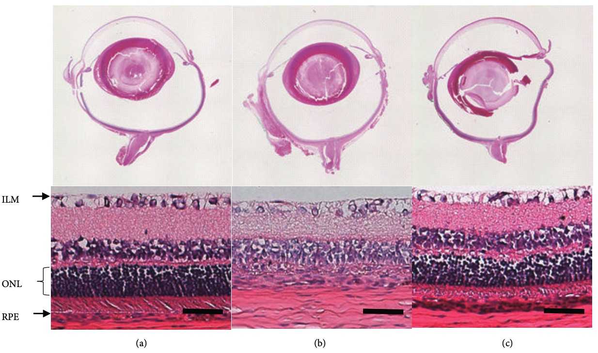Fig. 2 Histological retinal pictures of MNU-injected rats. (OA Literature)
