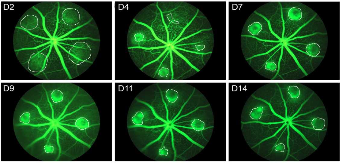 Fig. 1 Fluorescent pictures of CNV mouse model. (OA Literature)