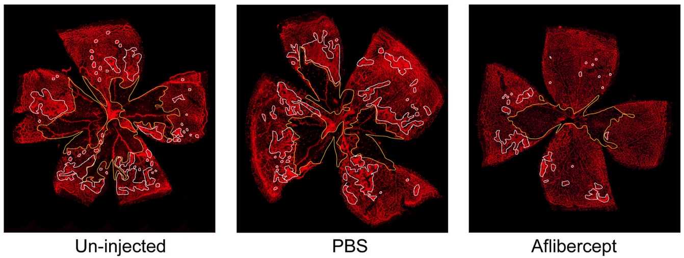 Fig. 1 Pictures of flat-mounted retinas from hyperoxia-induced retinal neovascularization mouse models. The avascular area is delineated in yellow, and the area of pre-retinal neovascularization is delineated in white. (OA Literature)