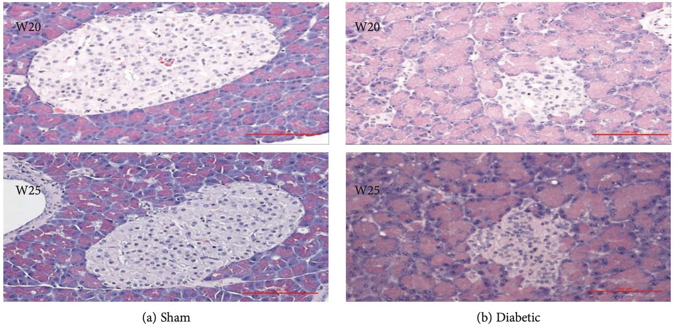 Fig. 2 Representative pictures of the pancreas from rats 20 and 25 weeks after STZ or sham injection stained with HE. (OA Literature)