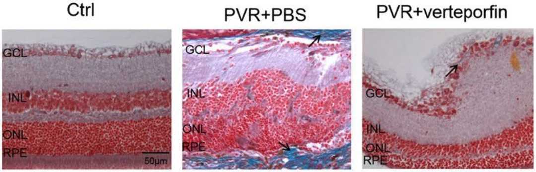 Fig 1. Pictures of the retinas of PVR mouse models stained with Masson. (OA Literature)