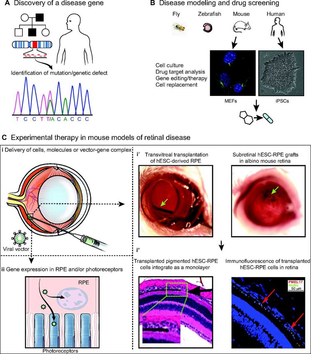 Fig.1 A comprehensive flow chart on gene discovery to therapy of retinal degenerative diseases. (OA Literature)