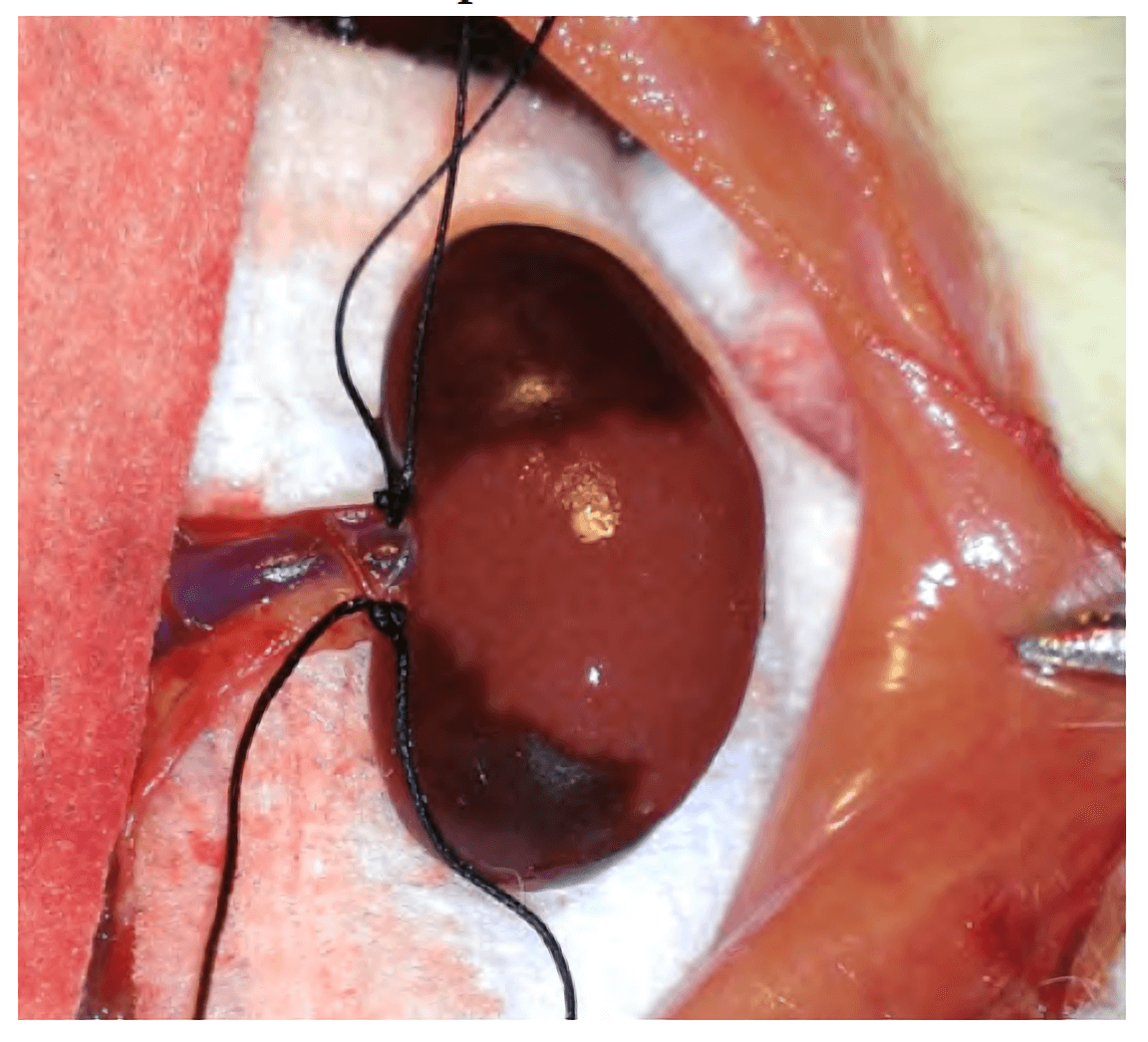 5/6 Nephrectomy Model