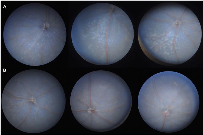 Fig.2 Comparing eye morphology and function in C57BL/6N and C57BL/6J mice. (OA Literature)