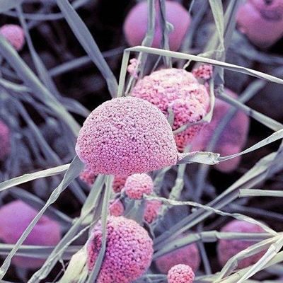 Antifungal Drug Discovery