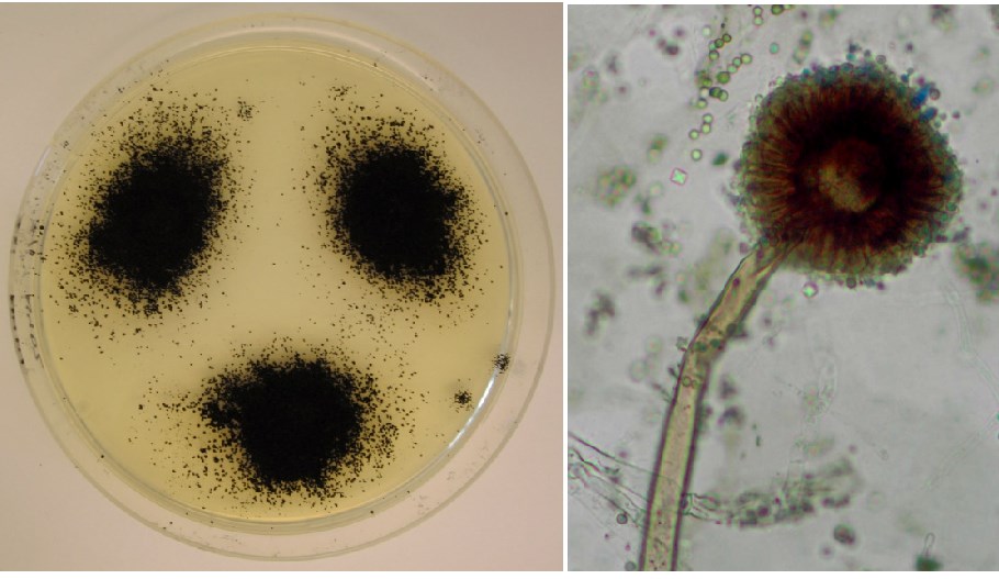 Morphology of A. Niger: two weeks old colonies growing on minimal media (left) and microscopic picture of a conidiophore, the structure producing asexual spores (right).