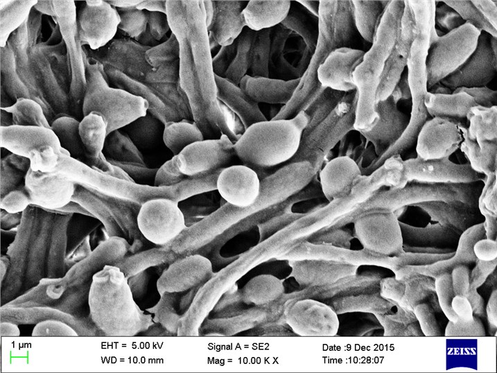 C. albicans visualised using scanning electron microscopy.