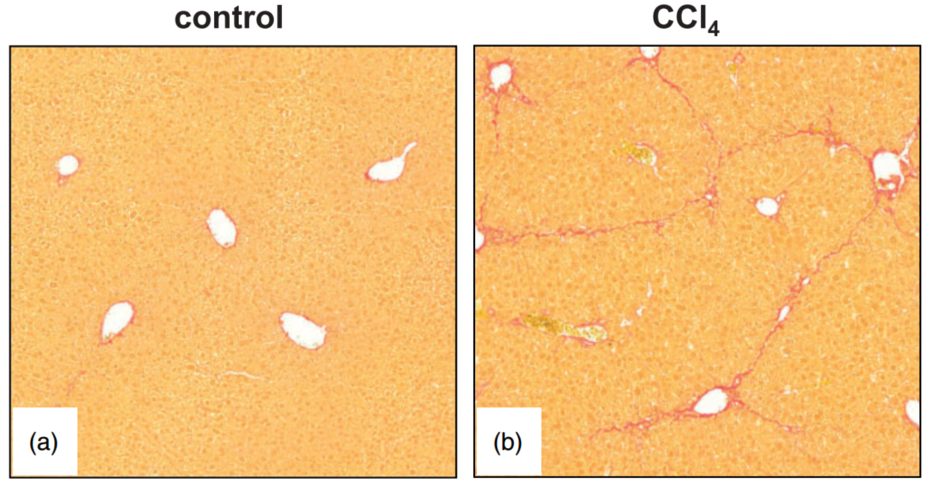Carbon Tetrachloride (CCl4)-Induced Rodent Hepatic Injury Model