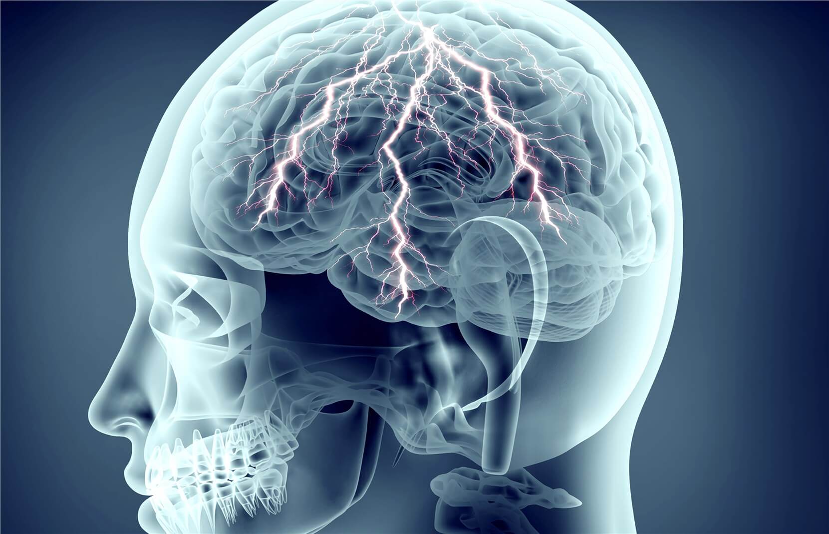 Chronic Constriction Injury (CCI) Model