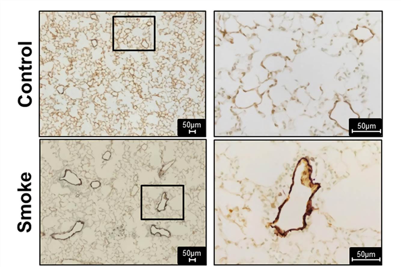 Fig.1 Cigarette smoke-induced pulmonary vascular remodeling in mice-histology. (Seimetz et al. 2015)