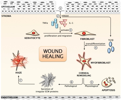 Corneal Wound Healing Model