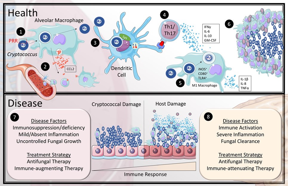 Current model of the immune response to Cryptococcus in health and disease.