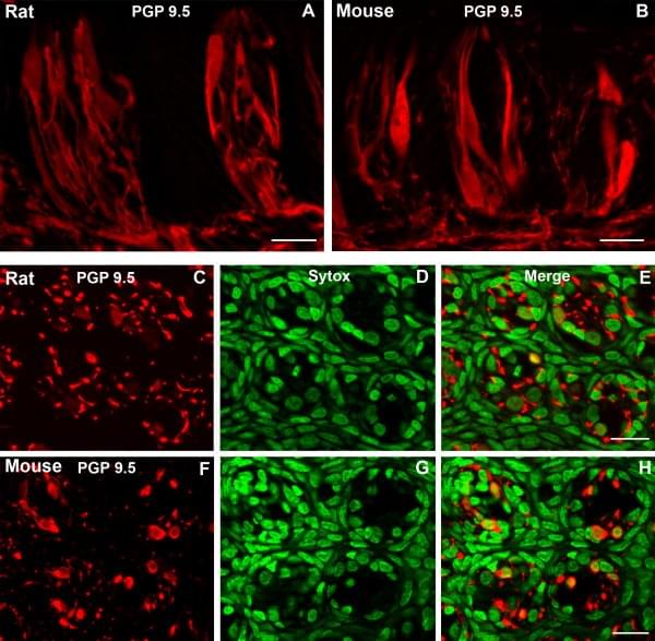 Figure 1. Confocal laser scanning microscopy (CLSM) images of PGP 9.5-LIR (PGP 9.5) in taste buds of rat and mouse circumvallate papillae. (Ma <em>et al.</em> 2007)
