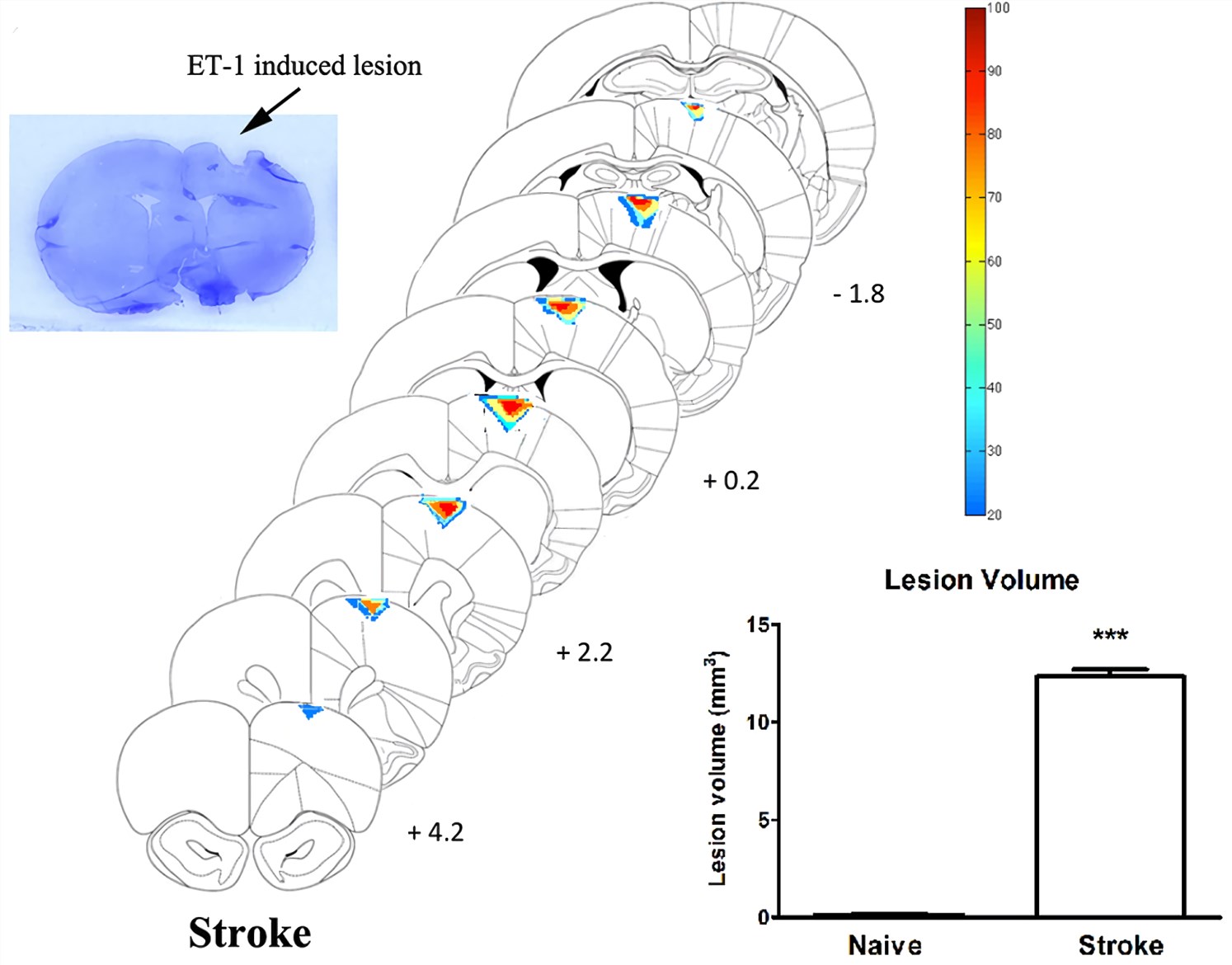 Fig.1 Histological examination of stroke lesion location and volume. (Chan et al. 2017)
