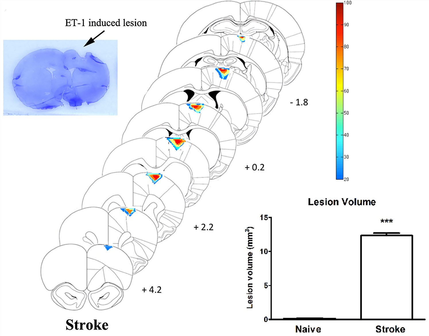 Endothelin-1 Rodent Model of Stroke & Brain Ischemia