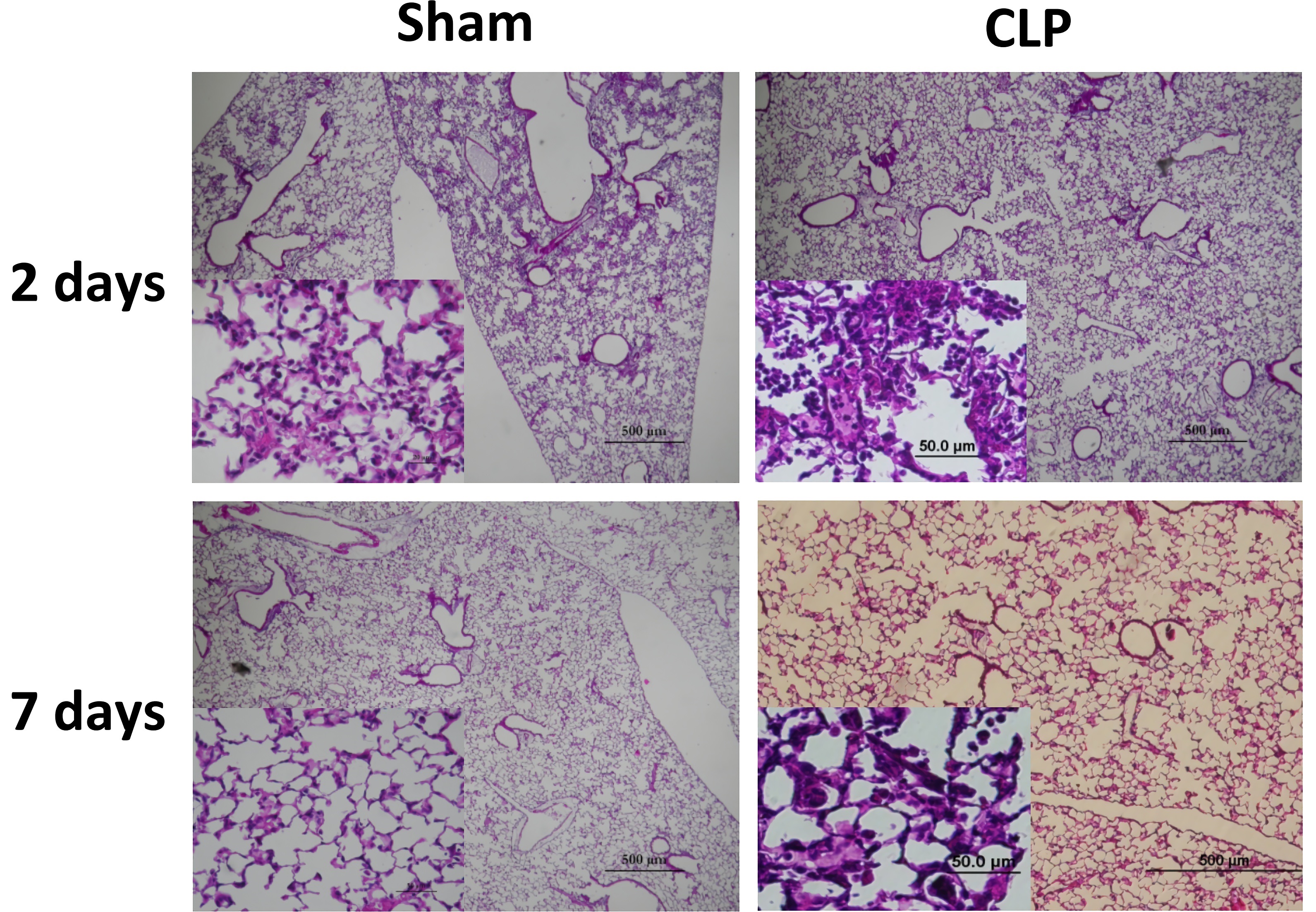Fig. 1 Lung histology of sham and CLP groups two days after Pseudomonas administration. (Restagno et al. 2016)
