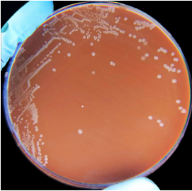 Haemophilus Influenzae