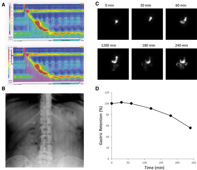 Examples of clinically used assessments of gastrointestinal (GI) motility.
