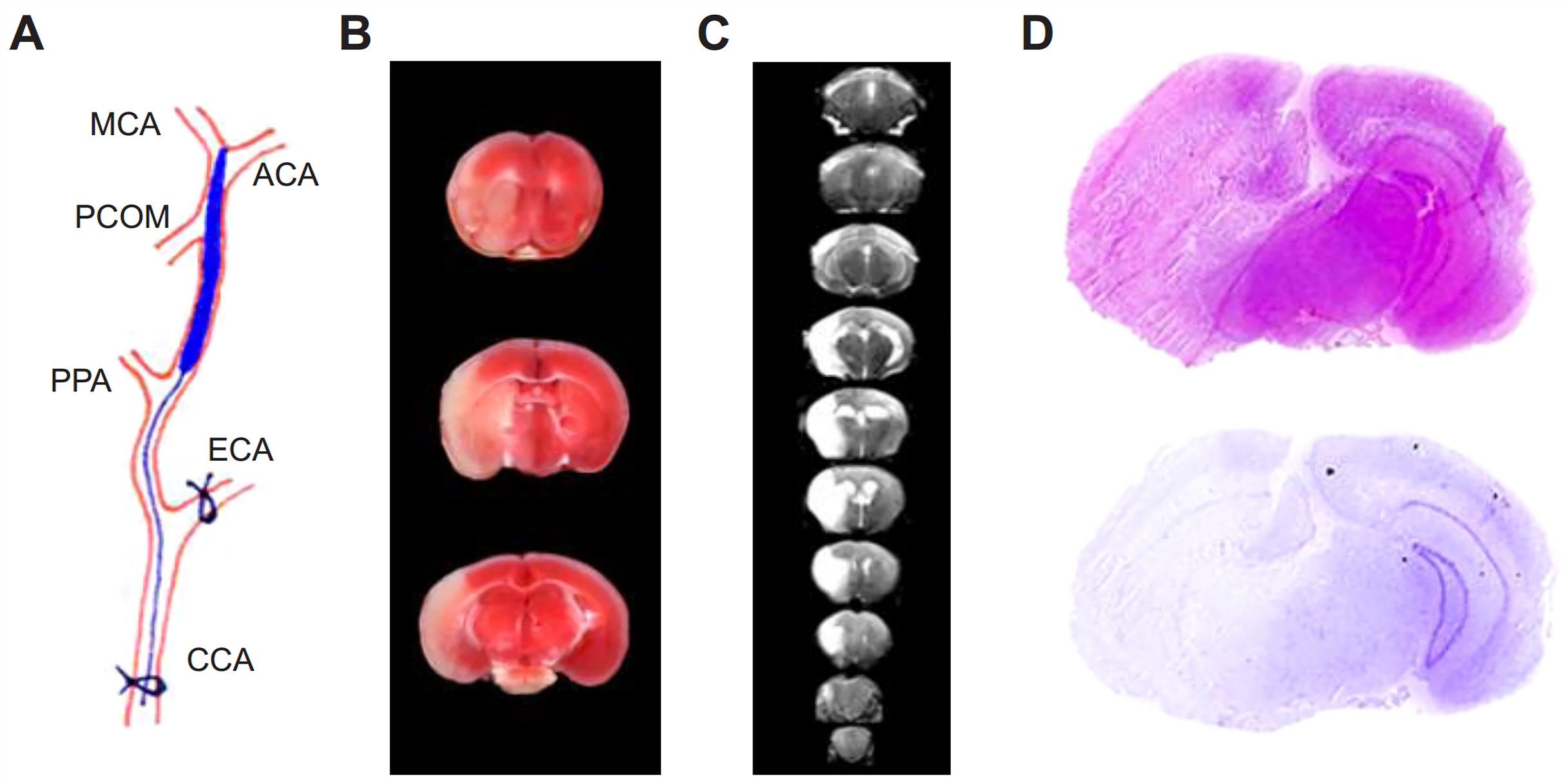 Middle Cerebral Artery Occlusion (MCAO) Rodent Model of Stoke & Brain Ischemia