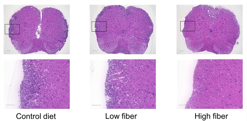 Fig.1 Histopathological assessment of the CNS shows that high-fiber diet ameliorates the disease severity of MOG-induced EAE. Mice were fed a high-fiber, low-fiber or control diet 2 weeks before immunization and throughout the study. (Mizuno et al. 2017)