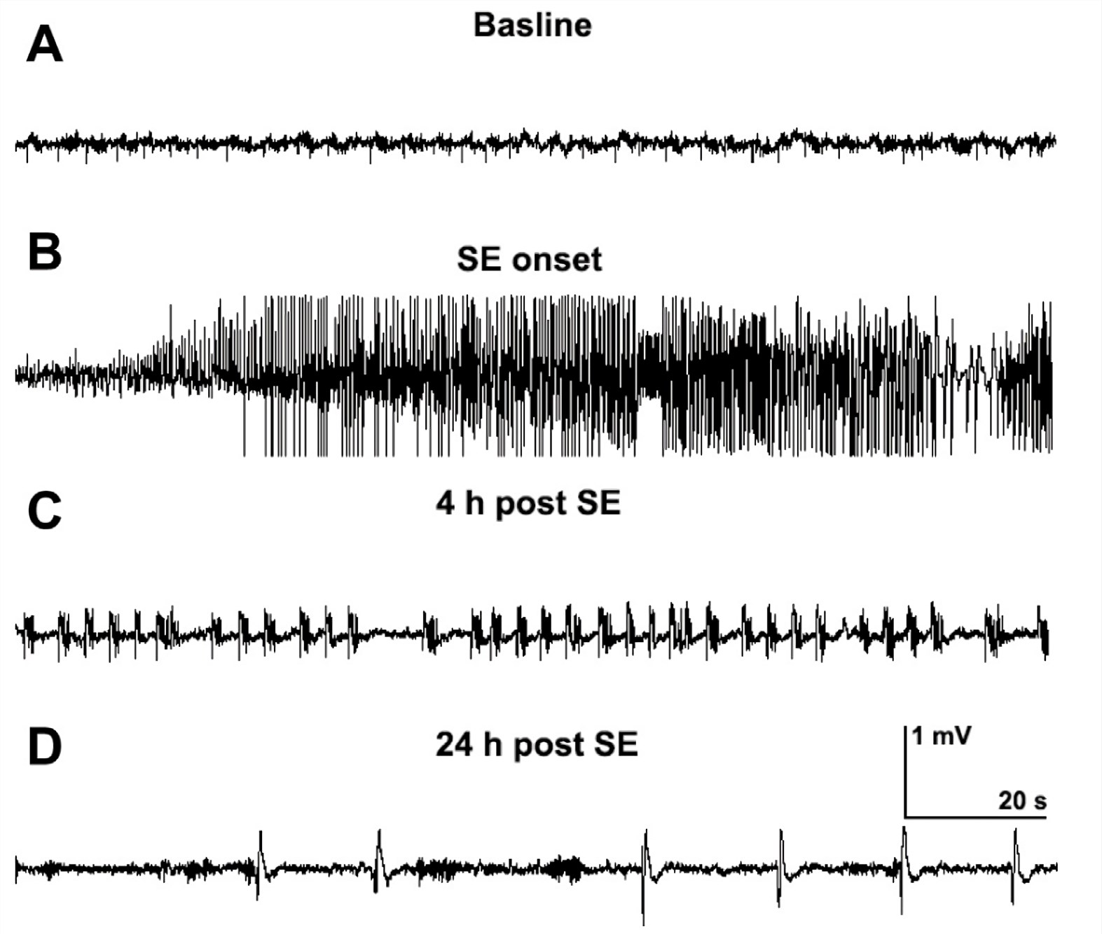 Rodent Lithium-Pilocarpine Model of Temporal Lobe Epilepsy (TLE)