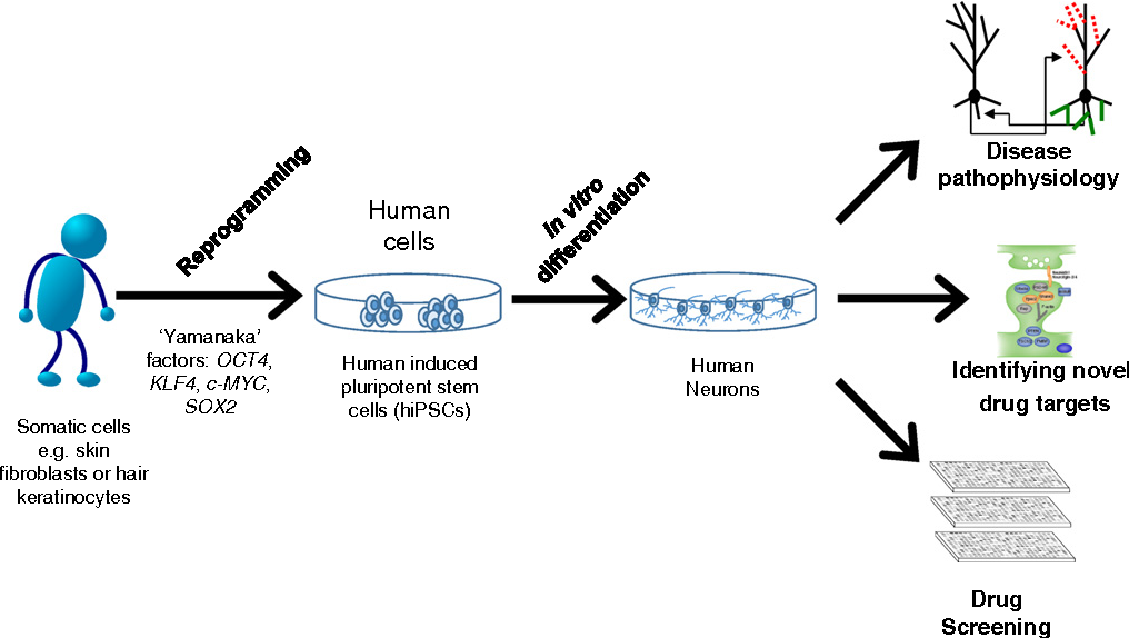 Promise of hiPSCs. Schematic representation of how somatic cells taken from patient factors, OCT4, KLF4, c-MYC, and SOX2. Subsequent differentiation of human iPSCs (hiPSCs) into n fication of potential drug targets. In addition, hiPSC derived neurons may function as a cellular. 