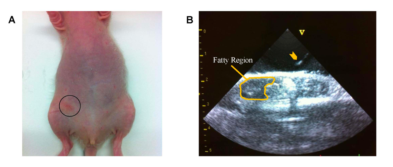 Fig. 1 Cell inoculation under ultrasound image guidance. (Nofiele, Joris Tchouala, and Hai-Ling Margaret Cheng, 2014)