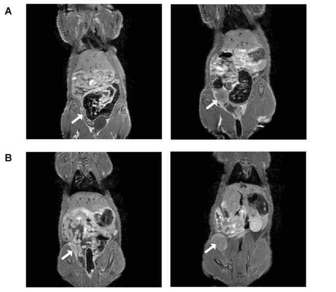 Fig. 2 In-vivo gadolinium contrast-enhanced magnetic resonance imaging (MRI) of orthotopic breast tumors in nude rats at 3 Tesla. (Nofiele, Joris Tchouala, and Hai-Ling Margaret Cheng, 2014)