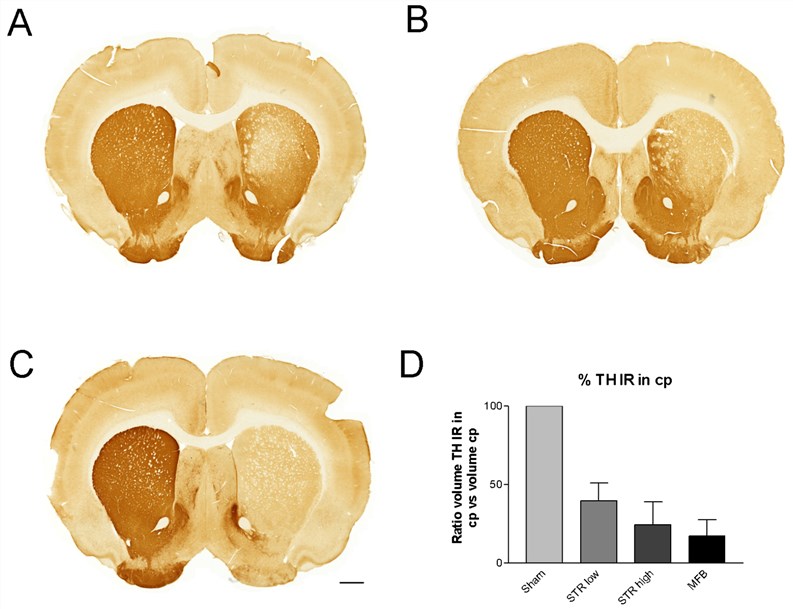 Fig.1 Histological analysis of 6-OHDA lesioned rats using tyrosine hydroxylase (TH) immunohistochemistry following striatal lesion using 10 μg (A) or 20 μg (B) 6-OHDA or following 6-OHDA lesioning of the medial forebrain bundle (C). (D) Cavalieri quantification of the proportion of TH immunoreactivity retained in the caudate putamen. (Vandeputte et al. 2010)