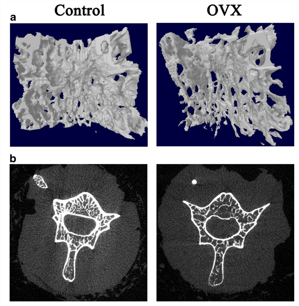 Ovariectomy (OVX)-Induced Osteoporosis in Rats