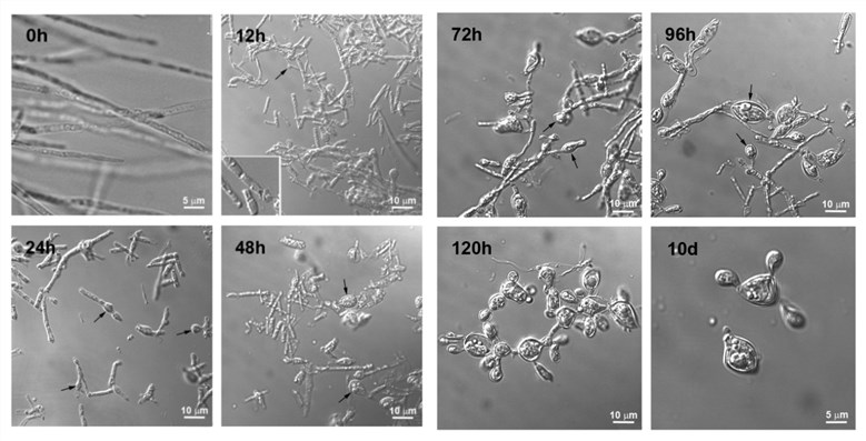 Time-lapsed transformation of P. brasiliensis hyphae to yeast forms.