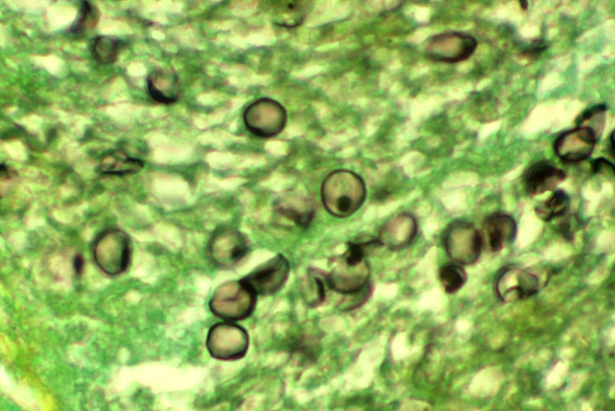 P. jirovecii cysts in tissue.