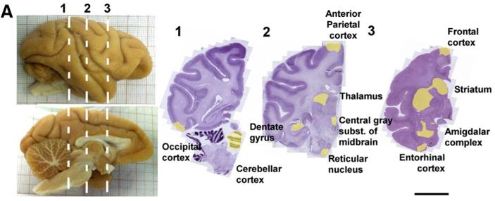 The distribution of AβOs in the brain.