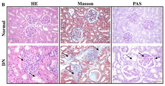 Fig.1 Histological staining of renal tissues in rhesus macaques of DN. (An, et al., 2019)