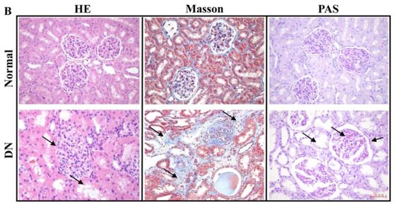 Histological staining of renal tissues in rhesus macaques of DN.