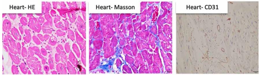Histology of a rhesus monkey of heart failure (HF) model.
