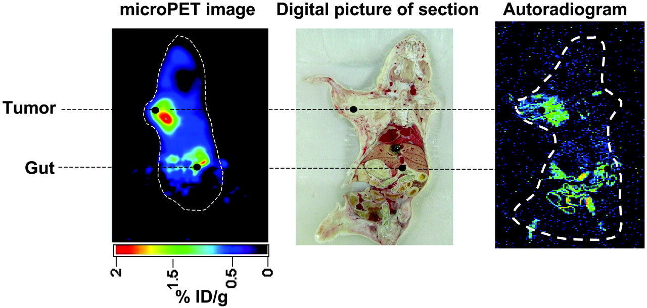 Anatomical corroboration of the microPET signal by digital whole-body autoradiography. 