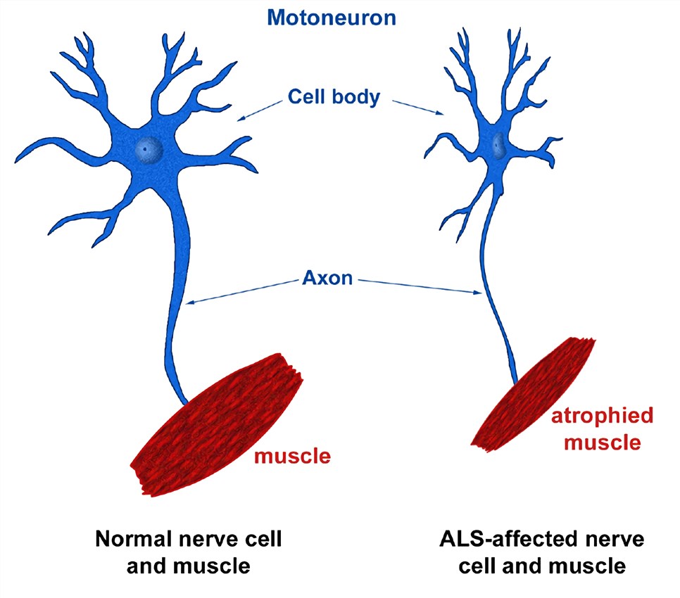 Rodent Amyotrophic Lateral Sclerosis (ALS) Model
