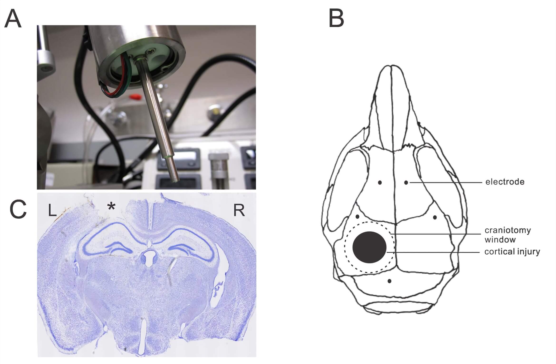 Fig.1 Controlled cortical impact (CCI) injury model in mice. (A) Impactor tip of an electromagnetic CCI device. (B) Schematic diagram of sites of craniotomy, cortical injury, and EEG electrode placements. (C) Cresyl violet-stained coronal section. (Guo et al. 2013)