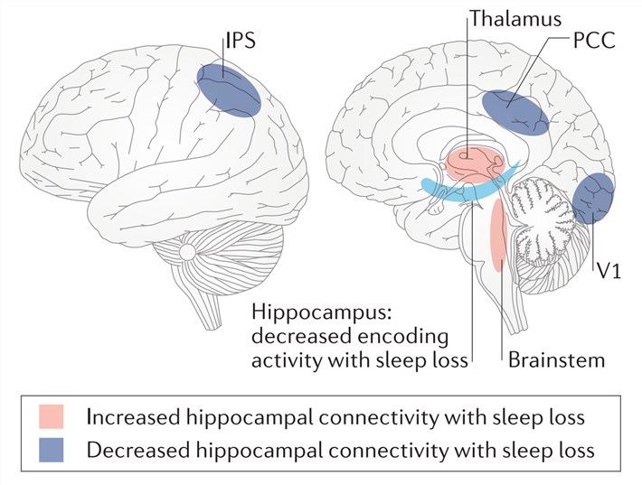 Sleep loss and hippocampal memory encoding.