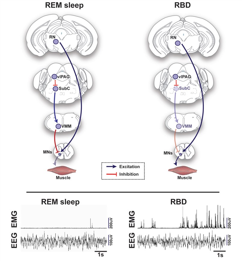 Fig.1 Schematic representation of circuits and pathways regulating muscle activity during “normal” rapid eye movement (REM) sleep and REM sleep behavior disorder (RBD) in the rodent brain. (Fraigne et al. 2015)